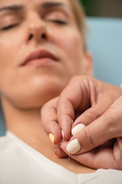 hypnopuncture