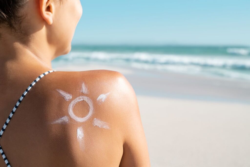 sunburn skin